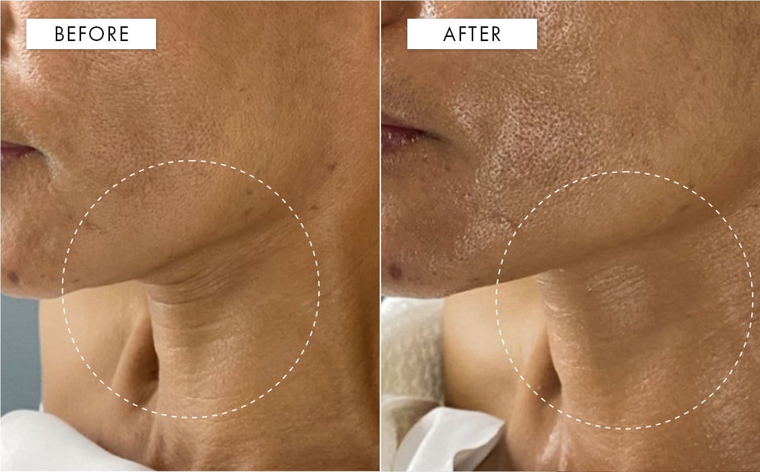 Impactful before & after results