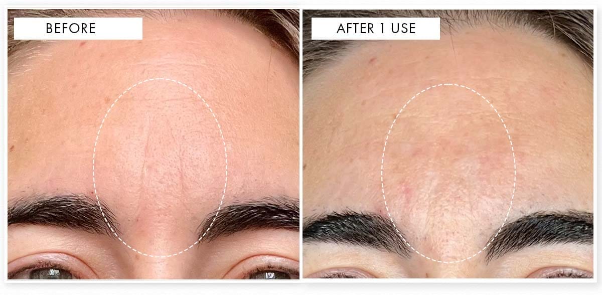 Before & After results after just one use