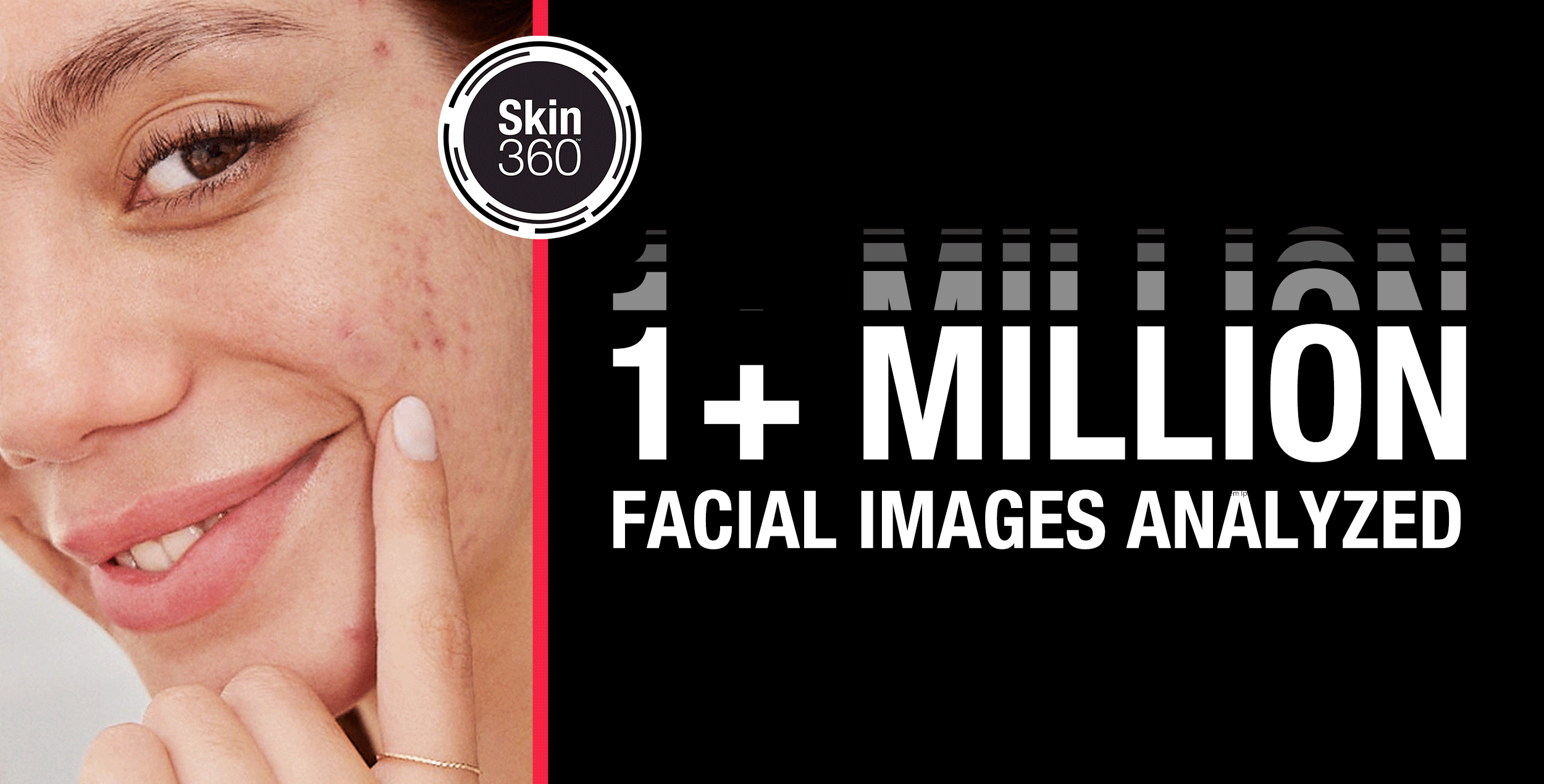 Skin360 - 1 Plus Million Facial Images Analyzed