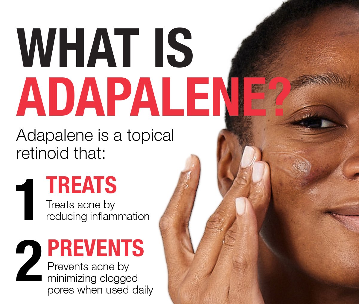 What Is Adapalene? - Adapalene is a topical retinoid that: 1 Treats - Treats acne by reducing inflammation - 2 Prevents - Prevents acne by minimizing clogged pores when used daily