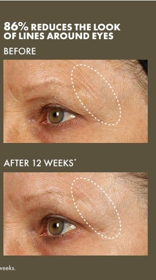 86% REDUCES THE LOOK OF LINES AROUND EYES | BEFORE | AFTER 12 WEEKS* | *Clinical testing on 35 women after using product for 12 weeks.