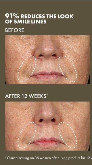 91% REDUCES THE LOOK OF SMILE LINES | BEFORE | AFTER 12 WEEKS* | *Clinical testing on 35 women after using product for 12 weeks.