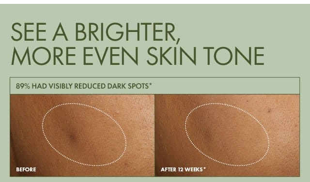 SEE A BRIGHTER, MORE EVEN SKIN TONE | 89% had visibly reduced dark spots* | Before | AFTER 12 WEEKS*