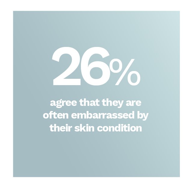 People have said that they are embarrassed by their skin condition