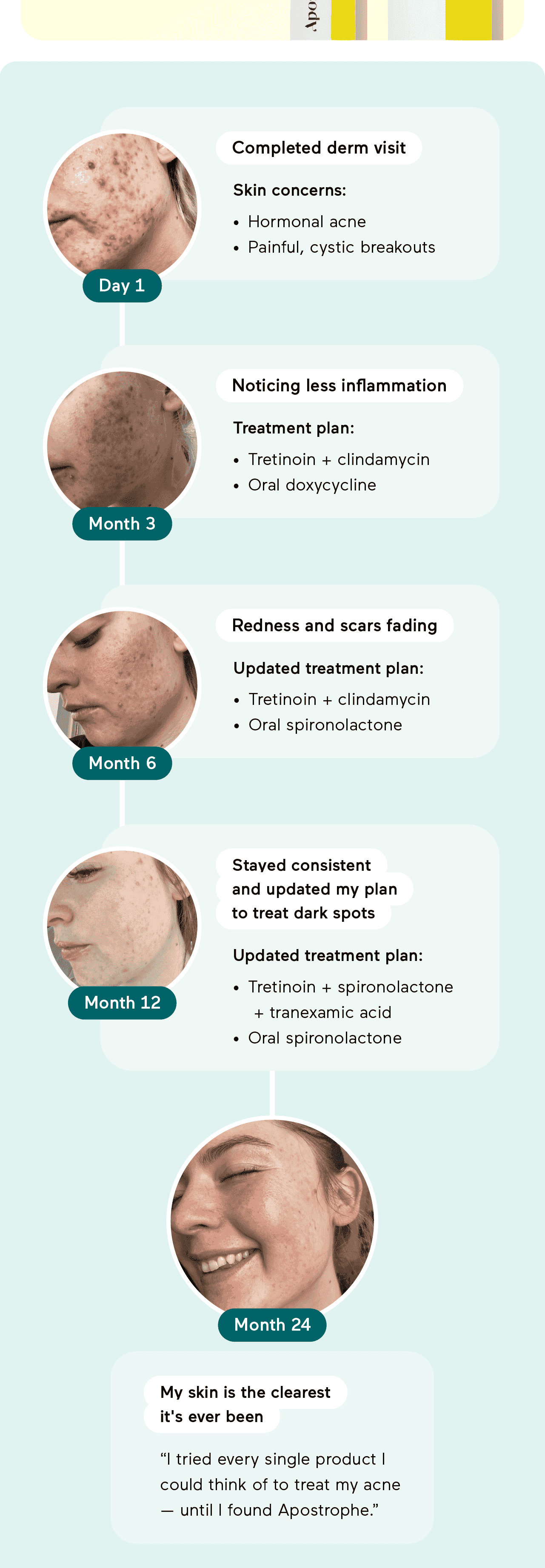 Day 1: Completed derm visit. Skin concerns: Skin concerns:Hormonal acne, Painful, cystic breakouts. Month 3: Noticing less inflammation. Treatment plan: Tretinoin + clindamycin, Oral doxycycline. Month 6: Redness and scars fading. Updated treatment plan: Tretinoin + clindamycin, Oral spironolactone. Month 12: Stayed consistent and updated my plan to treat my dark spots. Updated treatment plan: Tretinoin + spironolactone + tranexamic acid. Oral spironolactone. Month 24: My skin is the clearest it's ever been. I tried every single product I could think of to treat my acne - until I found Apostrophe.