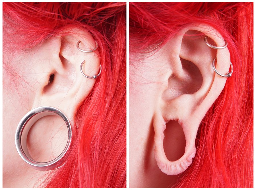 How do you prevent your lobes from thinning?