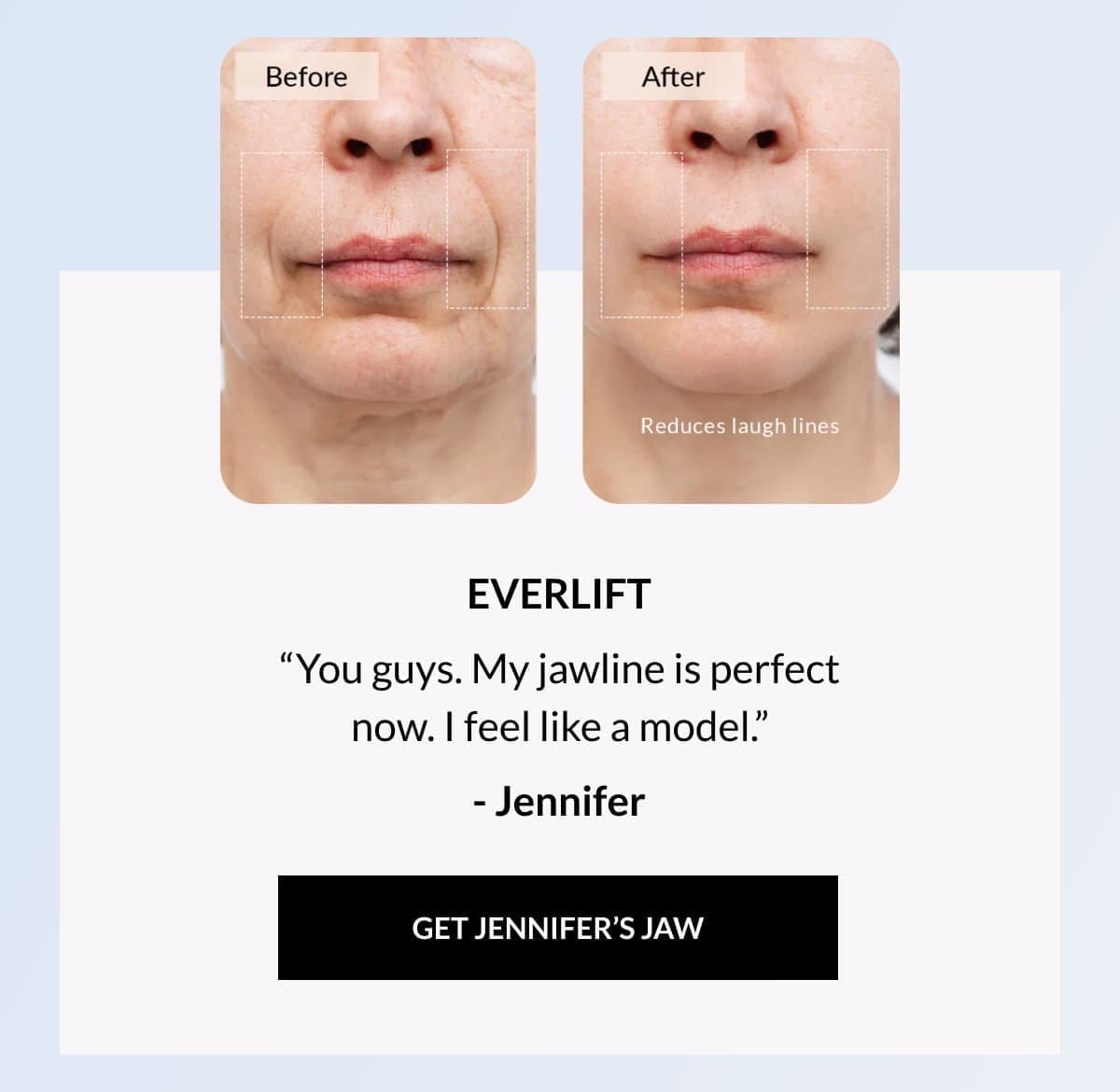 Everlift