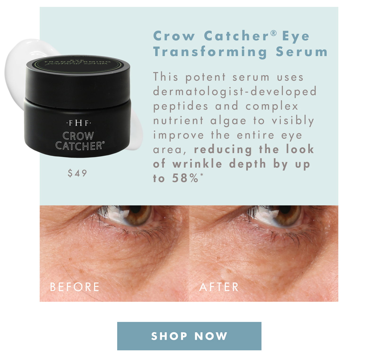 Crow Catcher® Eye Transforming Serum