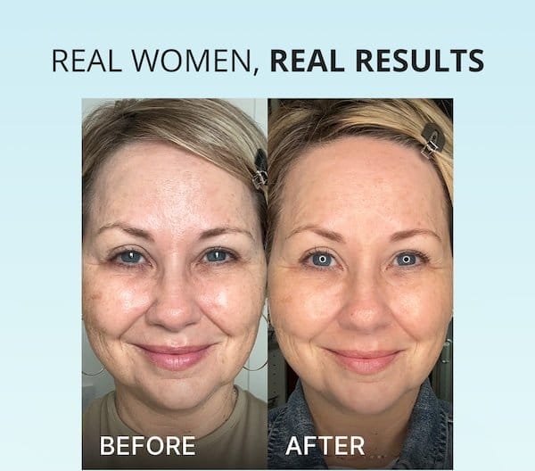 Real Women, Real Results - before and after customer photo