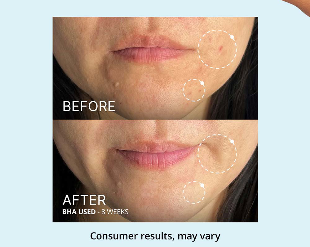 Customer before & after results (consumer results, may vary)