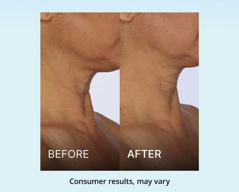 Customer before & after results (consumer results, may vary)