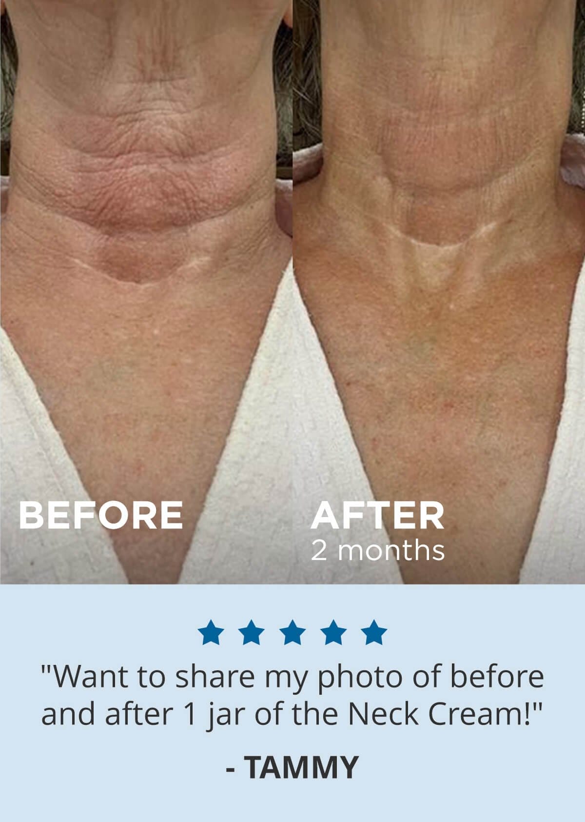 "Want to share my photo of before and after 1 jar of the Neck Cream!" - Tammy