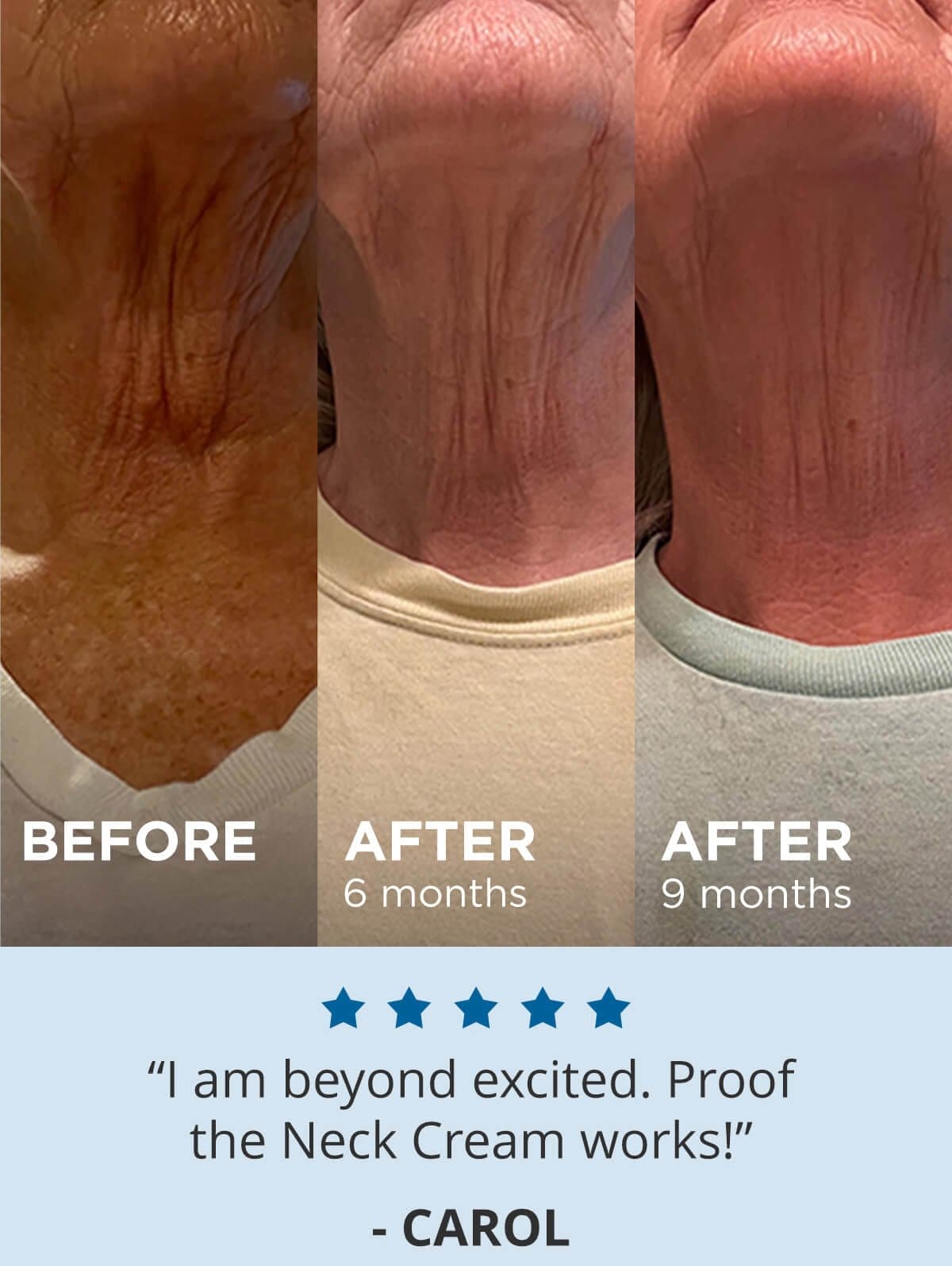 "I am beyond excited. Proof the Neck Cream works!" - Carol