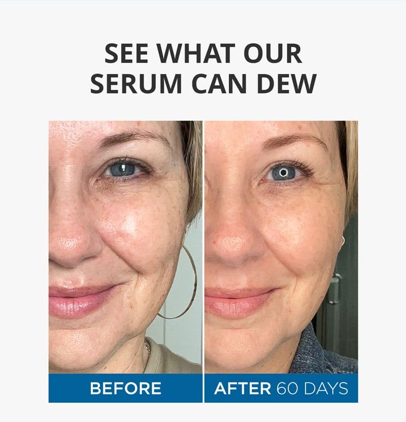 See What Our Serum Can DEW