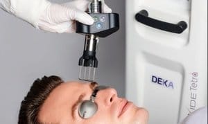 Up to 60% Off on CoolPeel Laser at Dvida Spa