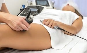 SculpSure Fat Removal Session