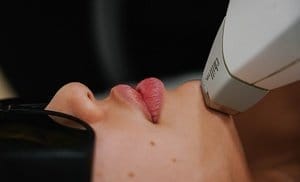 Laser Hair-Removal Sessions 