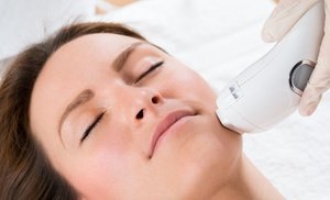 IPL Photofacials