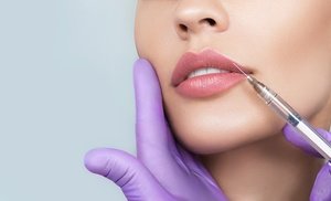 RHA Filler Injections