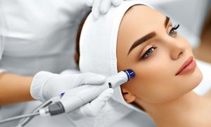 Up to 46% Off Diamond Microdermabrasion Treatments at Pure