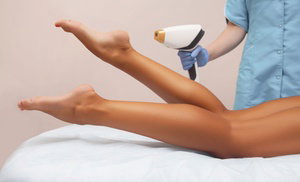 Laser Hair-Removal