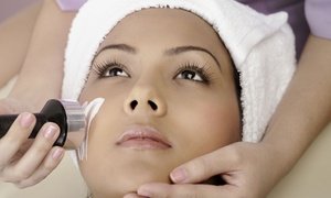 Up to 79% Off IPL Photofacials at Innovative MedSpa