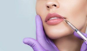 Up to 52% Off on RHA Filler Injections at Skinovatio Medical Spa - Gold Coast