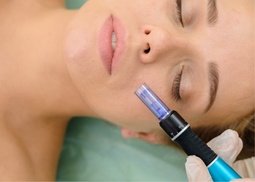 Up to 60% Off Microneedling and PRP at Skinovatio Medical Spa - Gold Coast