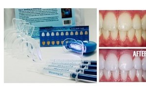 Home Teeth Whitening 3D Syste...