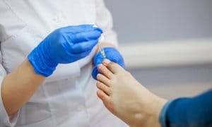 Up to 60% Off on Toe Fungus Treatment at Royal Podiatry Associates