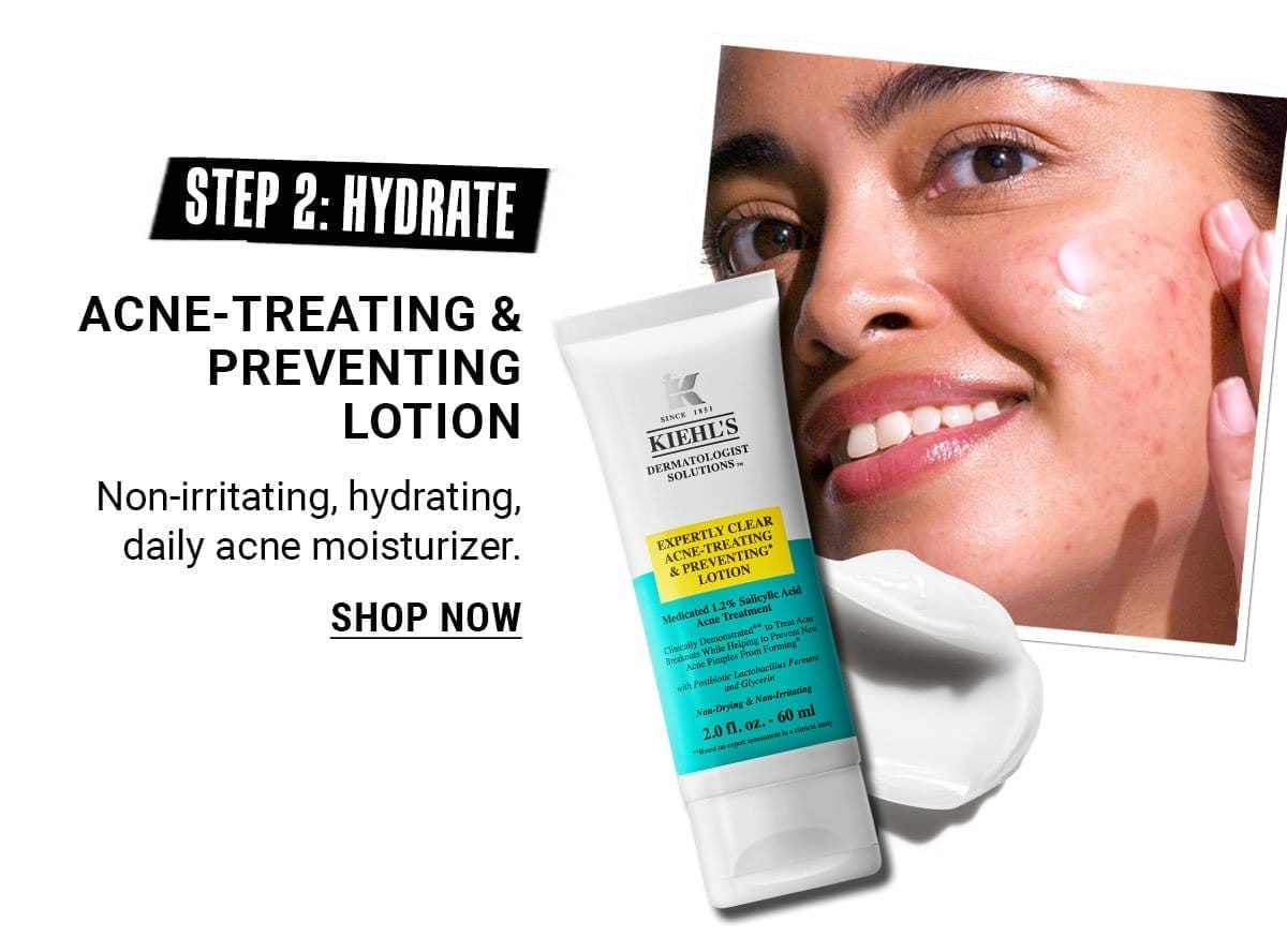 Acne Treating and Preventing Lotion