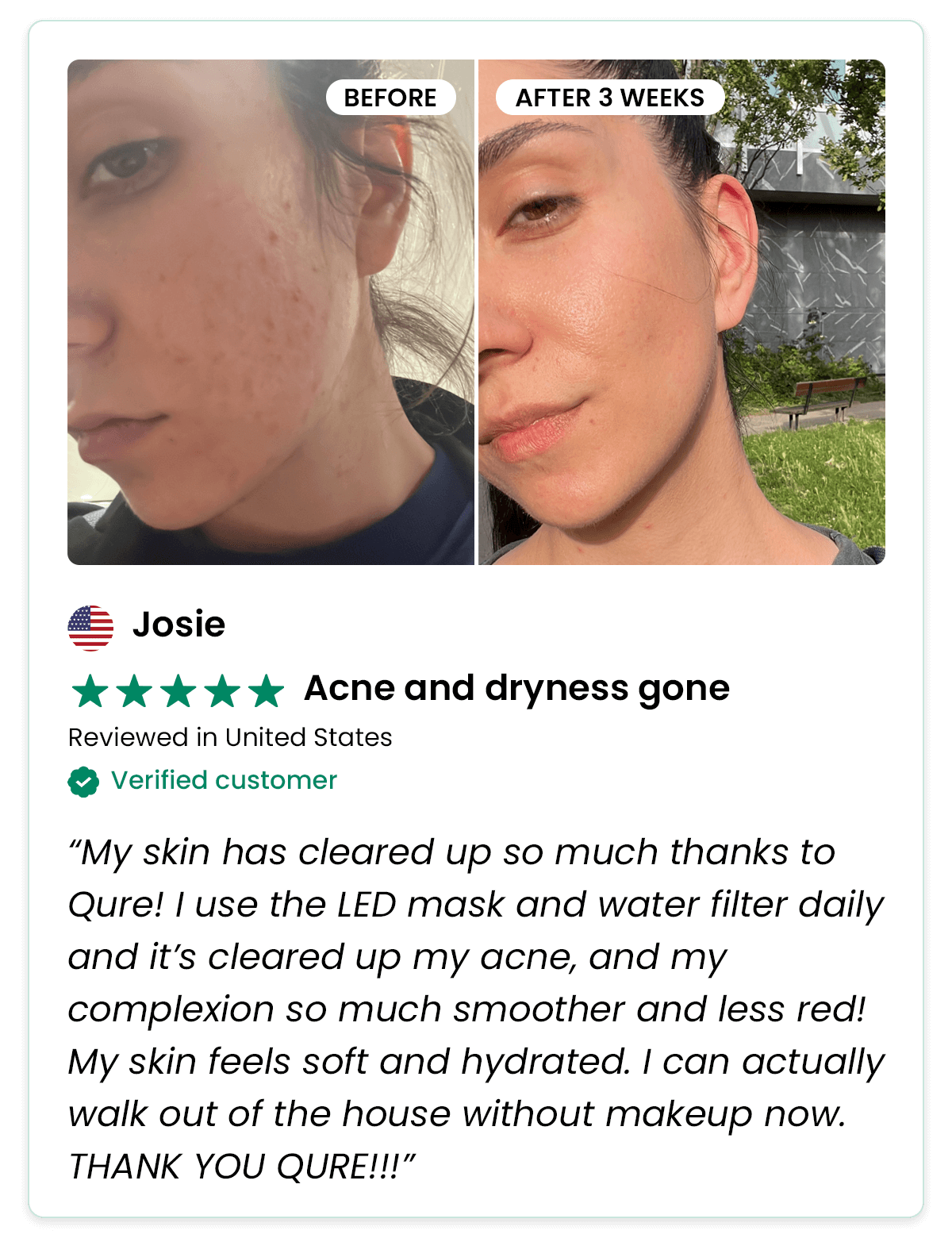 Acne and dryness gone - Josie