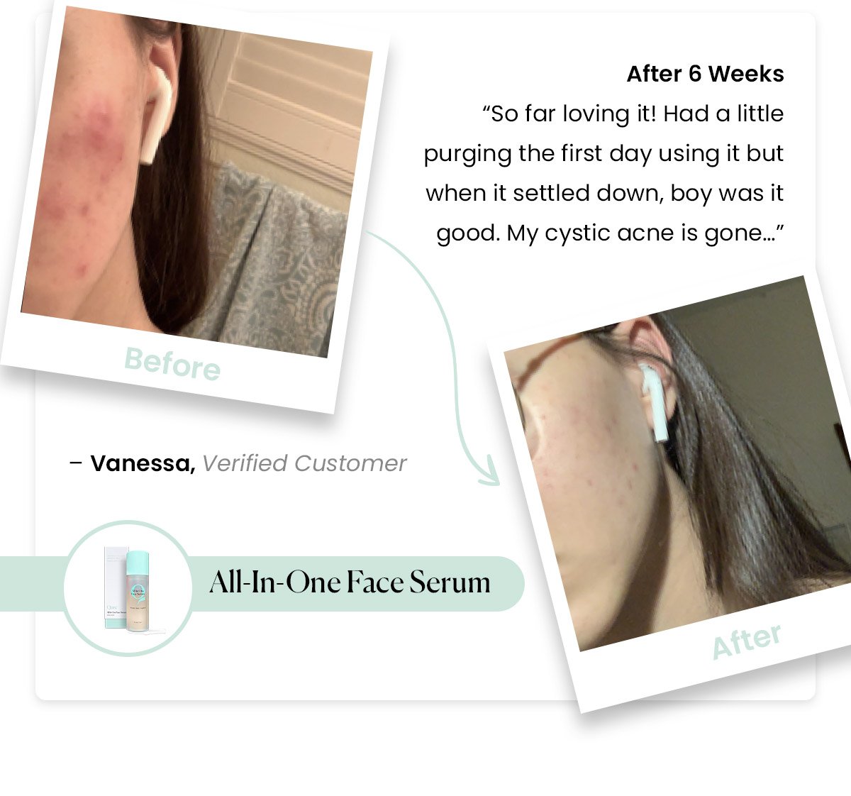 Vanessa Journey with All-In-One Face Serum