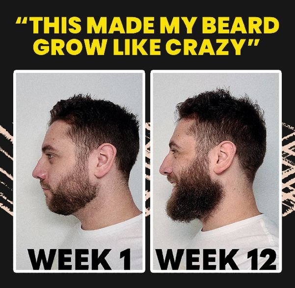 "This made my beard grow like crazy"