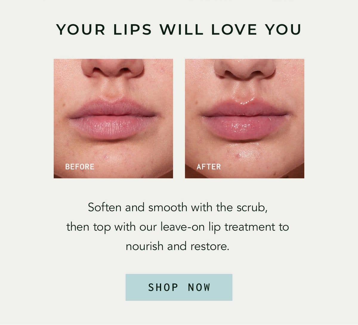 Your Lips Will Love You