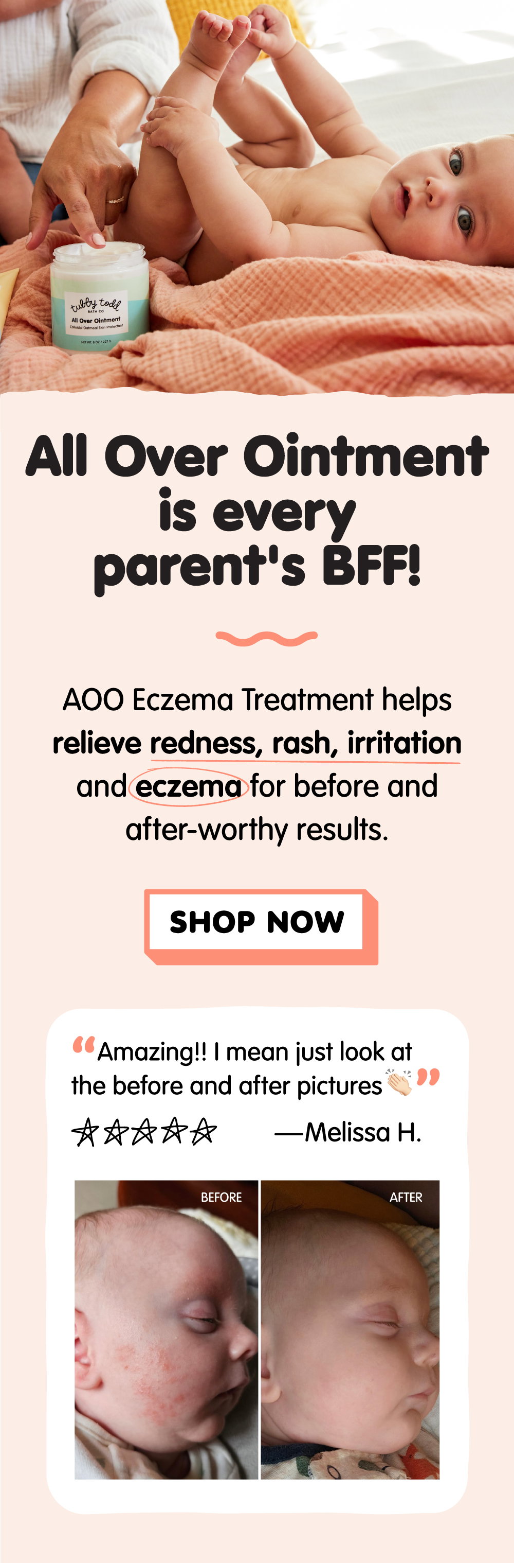 Shop All Over Ointment