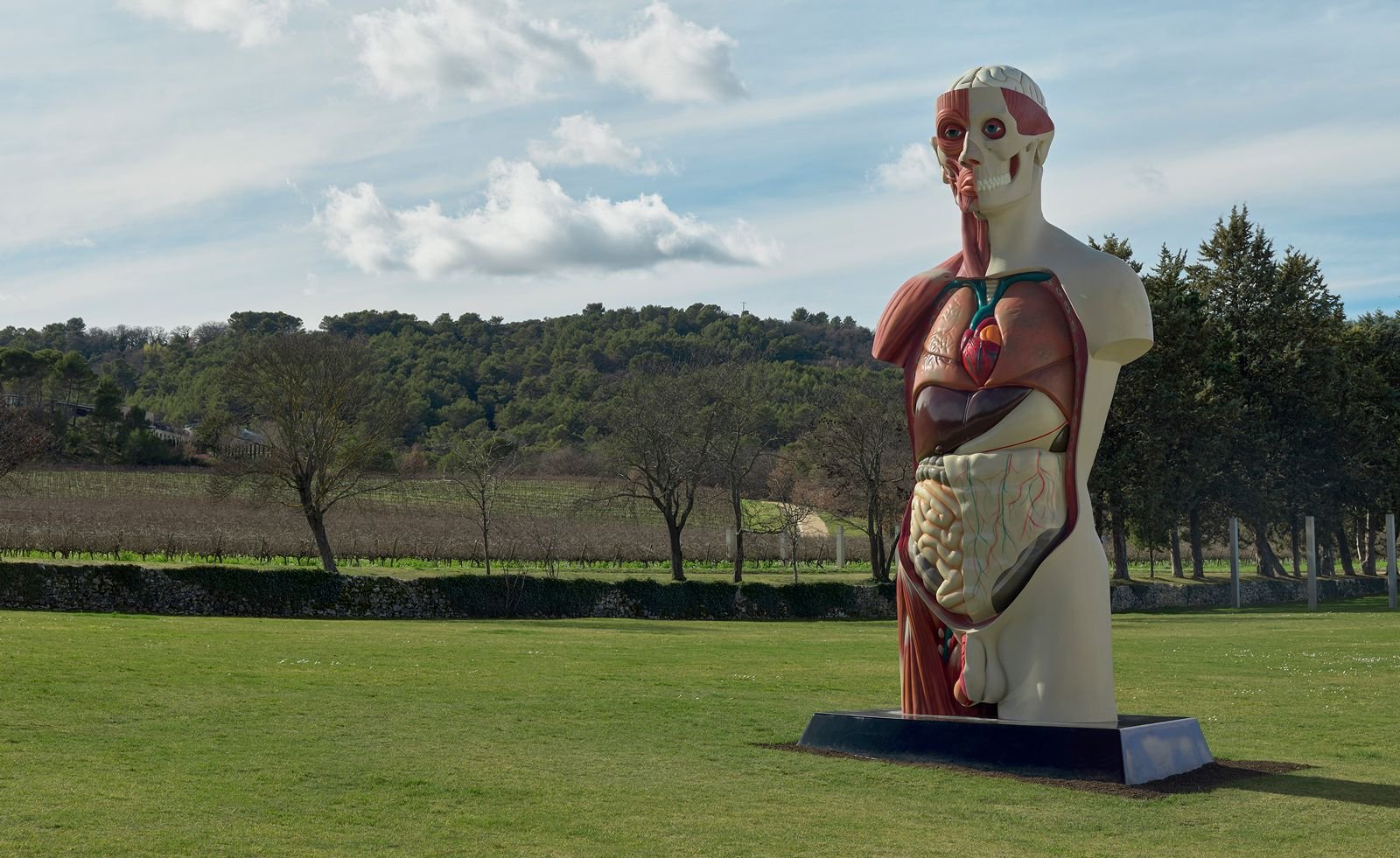 Damien Hirst anatomical sculpture outdoors