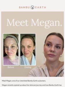 Skin Stories: Meet Megan