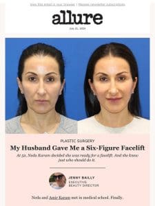 My Husband Gave Me a Facelift—See the Before and Afters