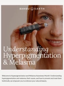 Understanding Hyperpigmentation and Melasma